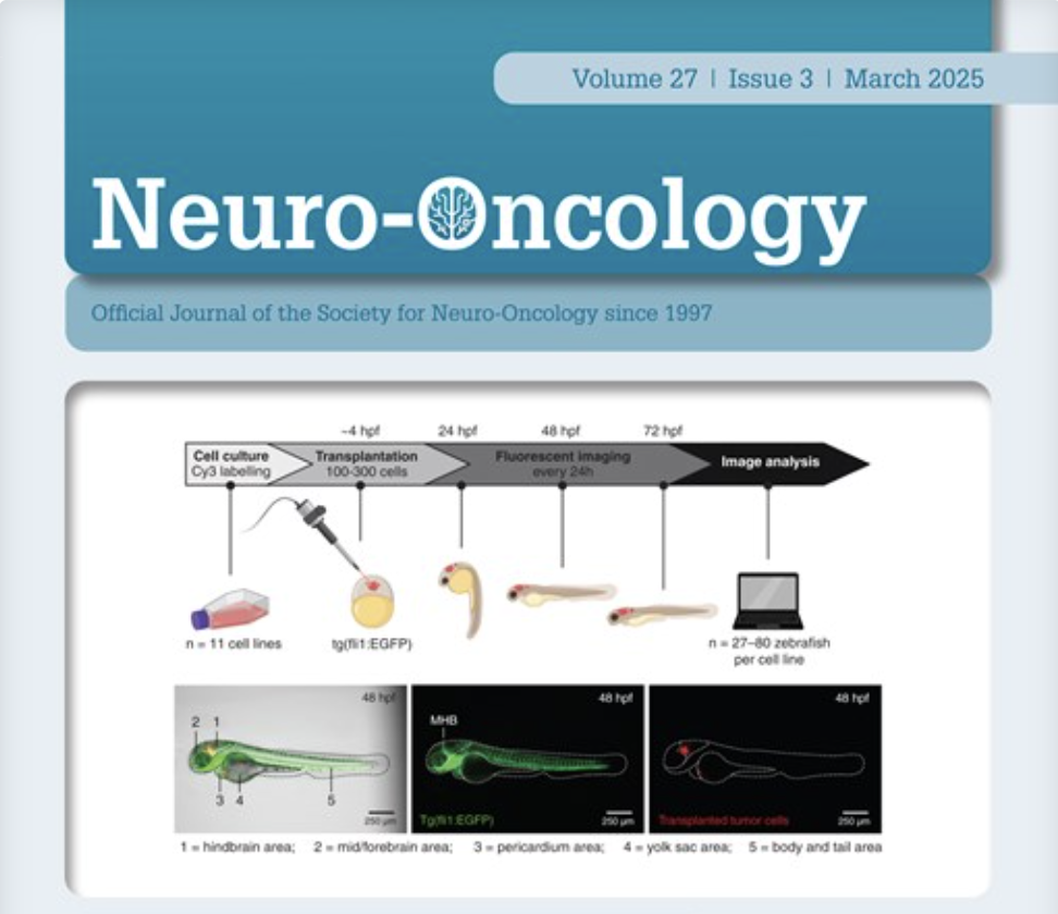 KL-50: A novel therapeutic agent targeting MGMT-deficient glioblastoma